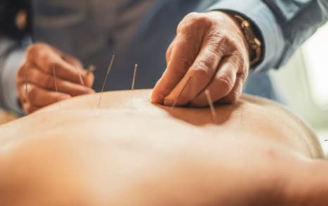 Acupressure therapy at Acutouch Wellness
